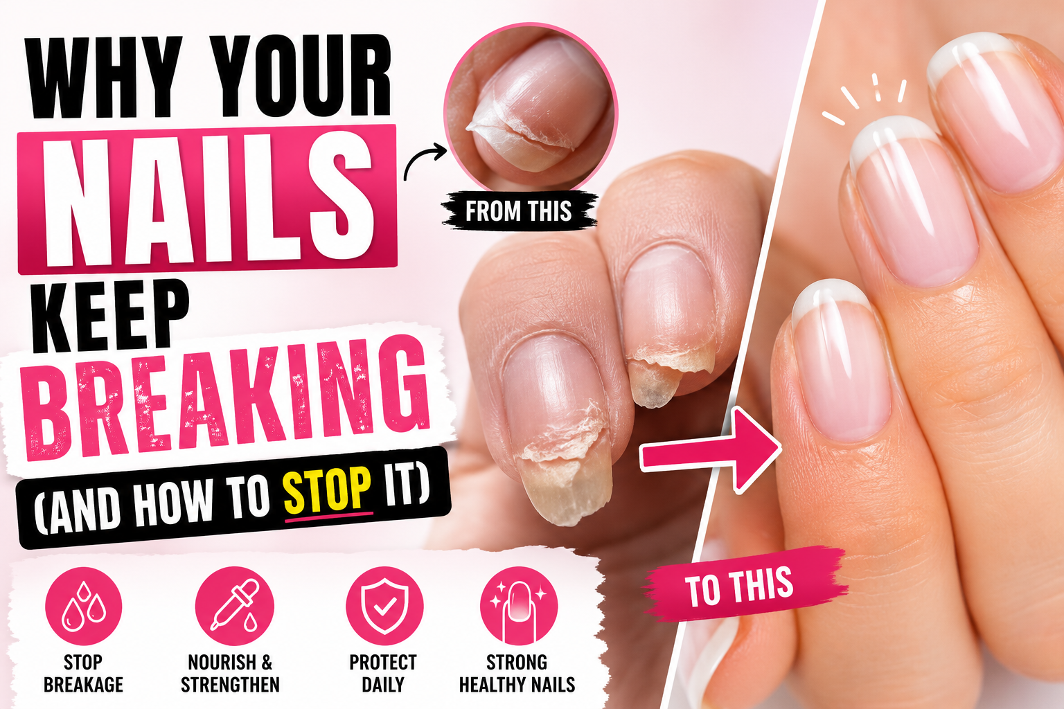 Why Your Nails Keep Breaking (And How to Stop It)